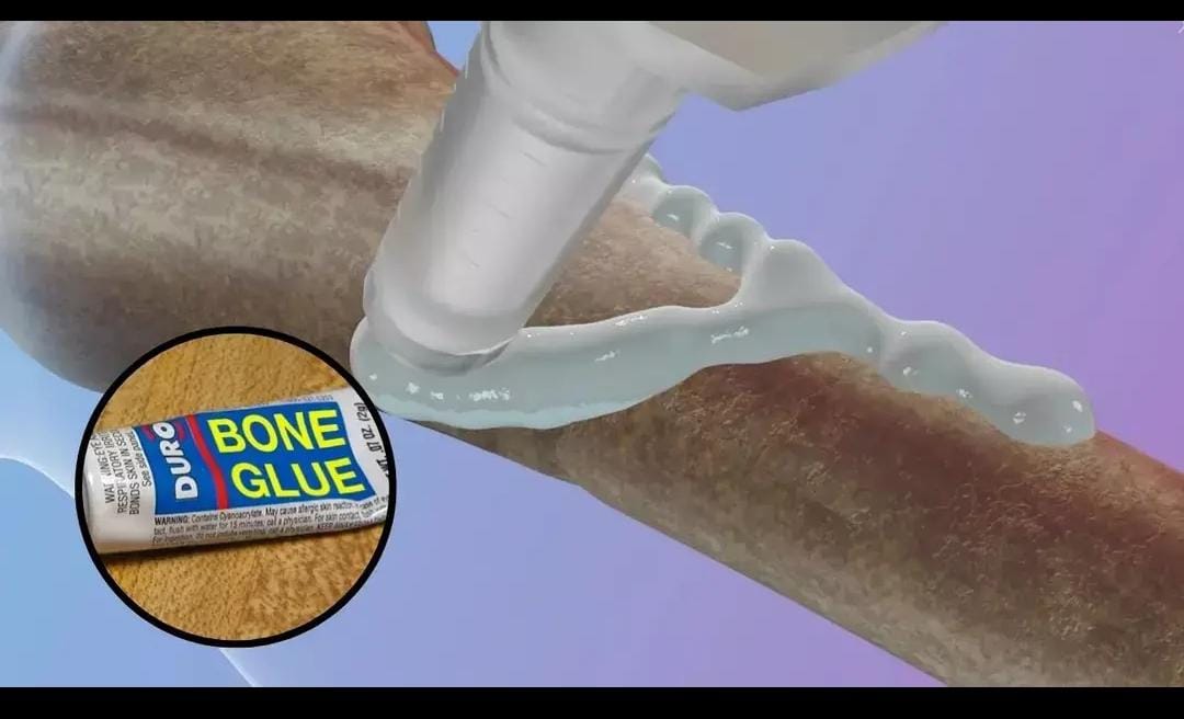 चीन ने बनाया Bone Glue: सिर्फ 3 मिनट में जुड़ जाएँगी टूटी हुई हड्डियाँ